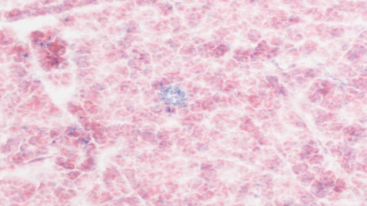 CAR_T_cells.jpg